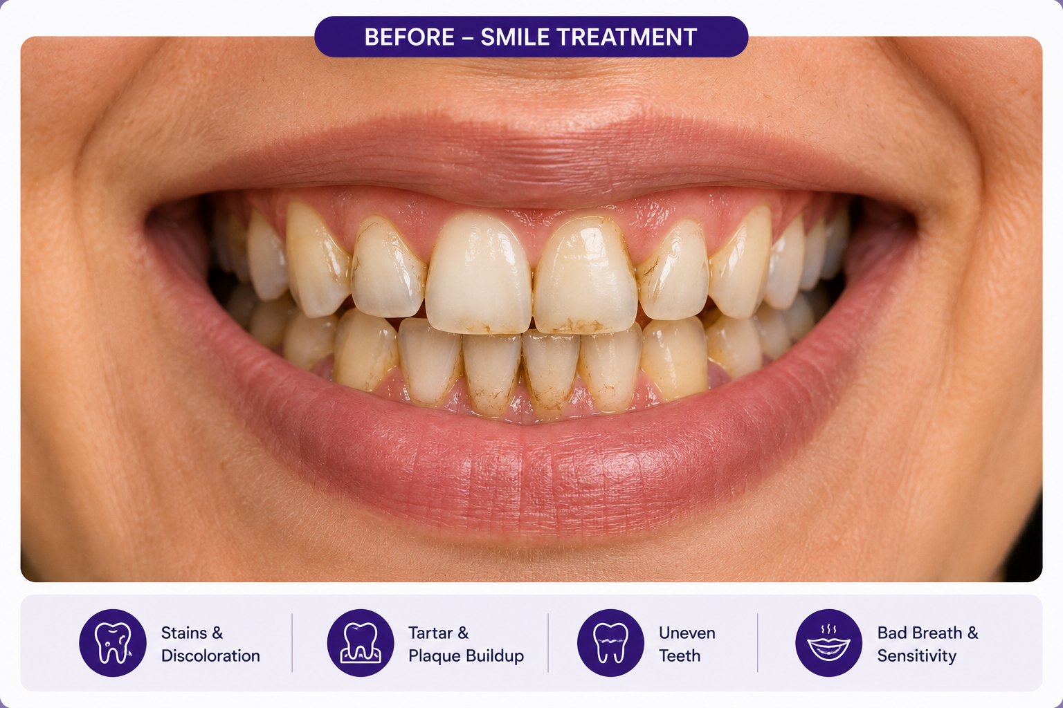 Before smile treatment result