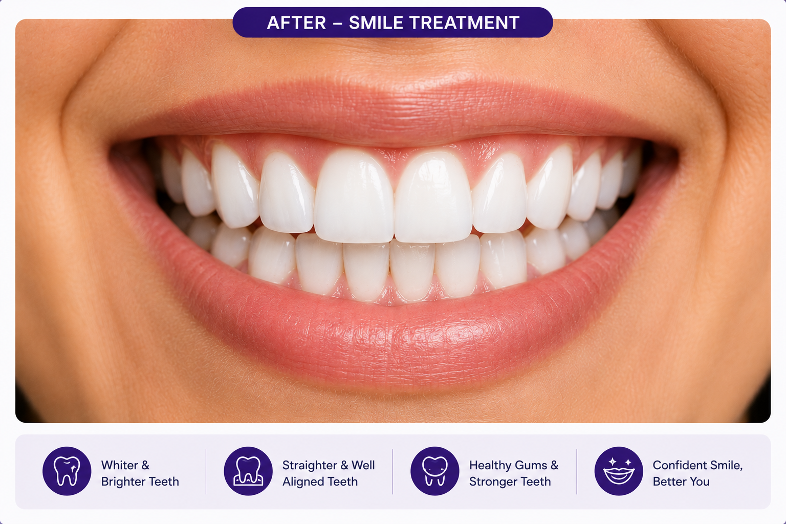 After smile treatment result
